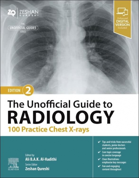 The Unofficial Guide to Radiology: 100 Practice Chest X-rays, 2nd Edition