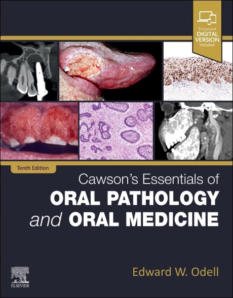 Cawson`s Essentials of Oral Pathology and Oral Medicine, 10th Edition