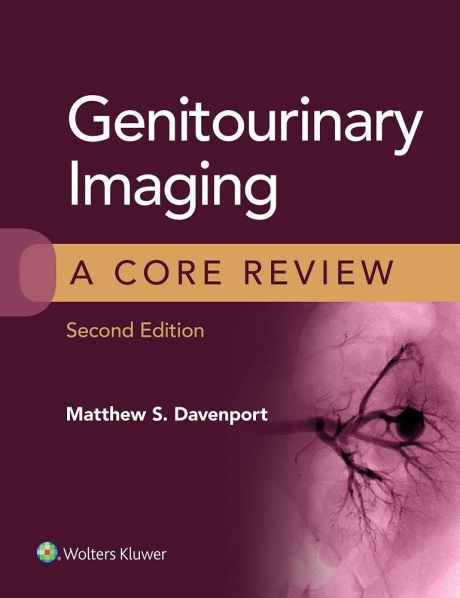 Genitourinary Imaging: A Core Review, 2nd Edition