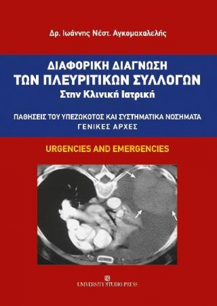 Διαφορική Διάγνωση των Πλευριτικών Συλλογών στην Κλινική Ιατρική