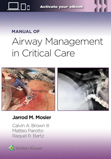 Manual of Airway Management in Critical Care