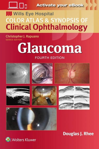 Wills Eye Institute Atlas Series: Glaucoma, 4th Edition