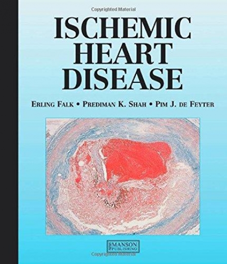 Ischemic Heart Disease