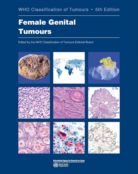 WHO Classification of Tumours: Female Genital Tumours, 5th Edition