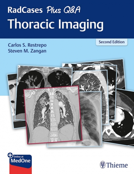 RadCases Plus Q&A: Thoracic Imaging, 2nd Edition