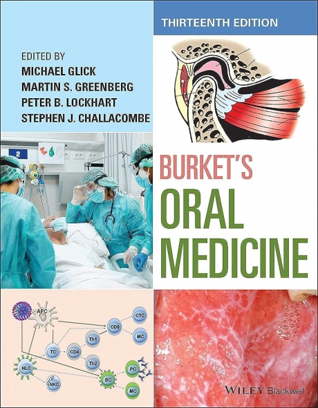 Burket`s Oral Medicine, 13th Edition