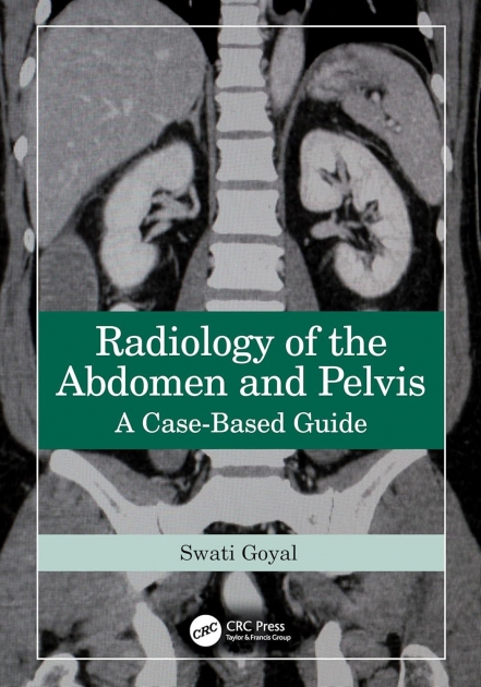 Radiology of the Abdomen and Pelvis: A Case-Based Guide