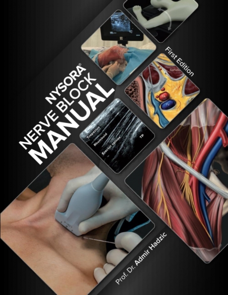 NYSORA Nerve Block Manual