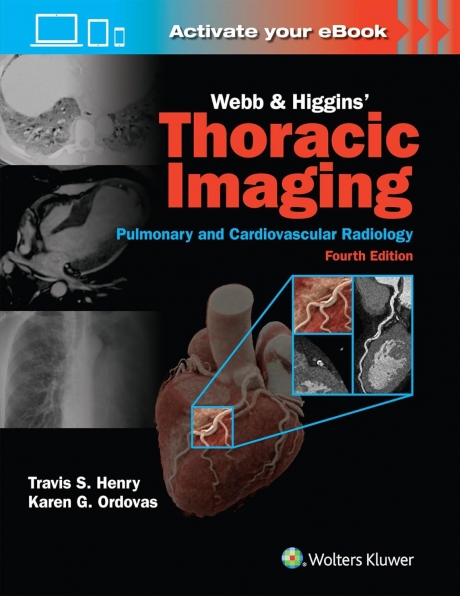 Webb & Higgins Thoracic Imaging, 4th Edition