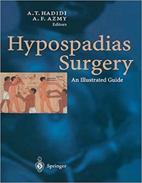 Hypospadias Surgery An Illustrated Guide