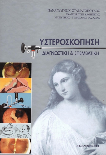 Υστεροσκόπηση: Διαγνωστική & Επεμβατική