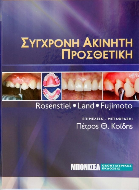 Σύγχρονη Ακίνητη Προσθετική