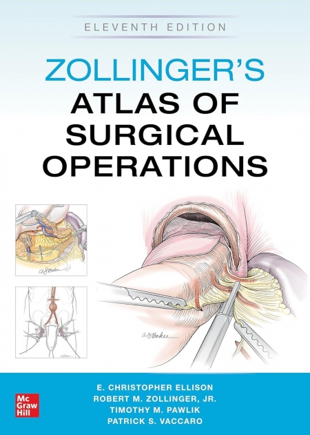 Zollinger`s Atlas of Surgical Operations, 11th Edition