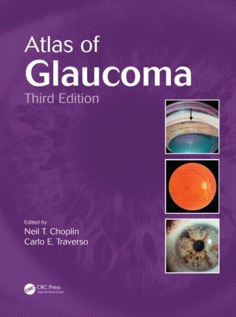 Atlas of Glaucoma, 3rd Edition