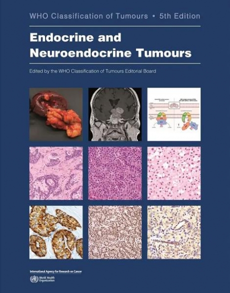 WHO Classification of Endocrine and Neuroendocrine Tumours, 5th Edition