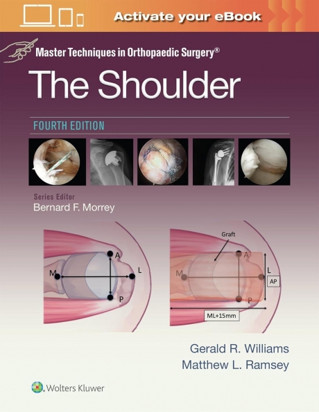 Master Techniques in Orthopaedic Surgery: The Shoulder, 4th Edition