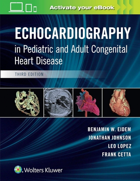 Echocardiography in Pediatric and Adult Congenital Heart Disease, 3rd Edition