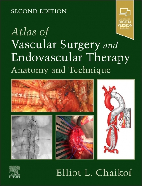 Atlas of Vascular Surgery and Endovascular Therapy: Anatomy and Technique, 2nd Edition