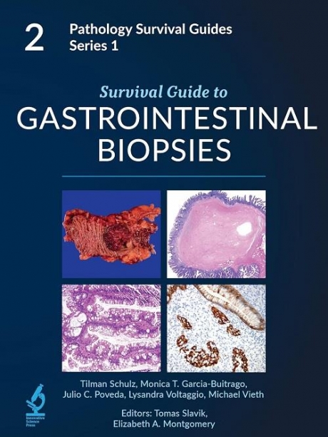 Survival Guide to Gastrointestinal Biopsies, 2nd Edition