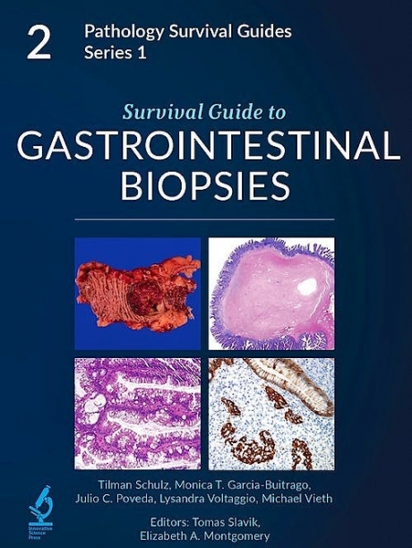 Survival Guide to Gastrointestinal Biopsies, 2nd Edition