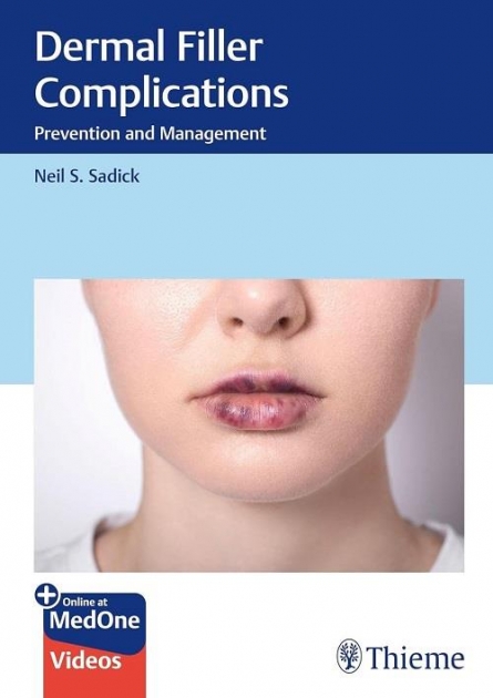 Dermal Filler Complications Prevention and Management