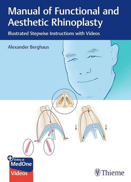 Manual of Functional and Aesthetic Rhinoplasty: Illustrated Stepwise Instructions with Videos