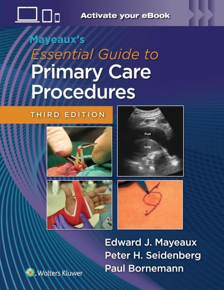 Mayeaux`s Essential Guide to Primary Care Procedures, 3rd Edition