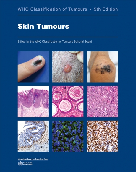 WHO Skin Tumours, 5th Edition