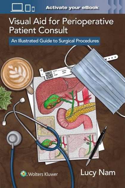 Visual Aid for Perioperative Patient Consult: An Illustrated Guide to Surgical Procedures