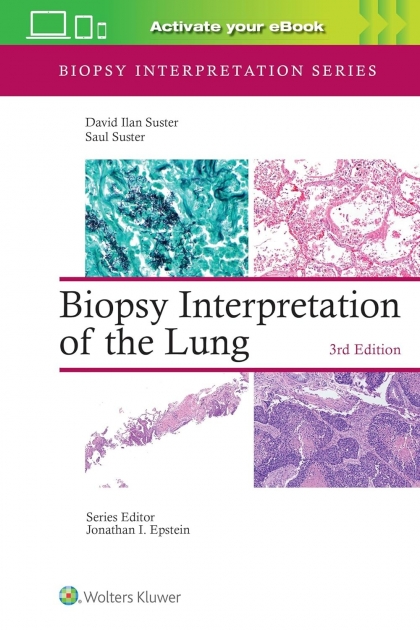 Biopsy Interpretation of the Lung: Print + ebook with Multimedia, 3rd Edition