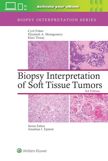 Biopsy Interpretation of Soft Tissue Tumors: Print + eBook with Multimedia, 3rd Edition