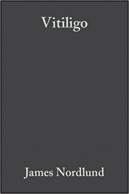 Vitiligo: A Comprehensive Monograph on Basic and Clinical Science