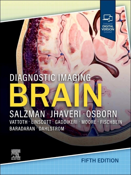 Diagnostic Imaging: Brain, 5th Edition