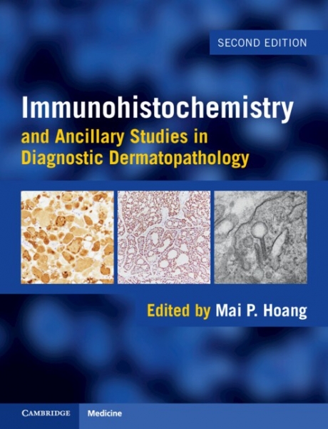 Immunohistochemistry and Ancillary Studies in Diagnostic Dermatopathology 2nd Edition