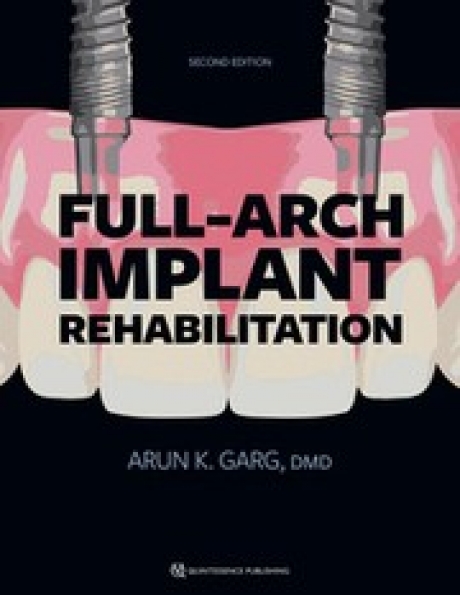 Full-Arch Implant Rehabilitation, 2nd Edition