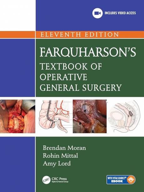Farquharson`s Textbook of Operative General Surgery, 11th Edition