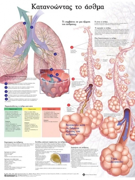 Ανατομικός Χάρτης: Κατανοώντας το Άσθμα