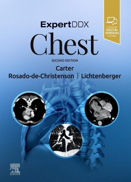 ExpertDDx: Chest, 2nd Edition