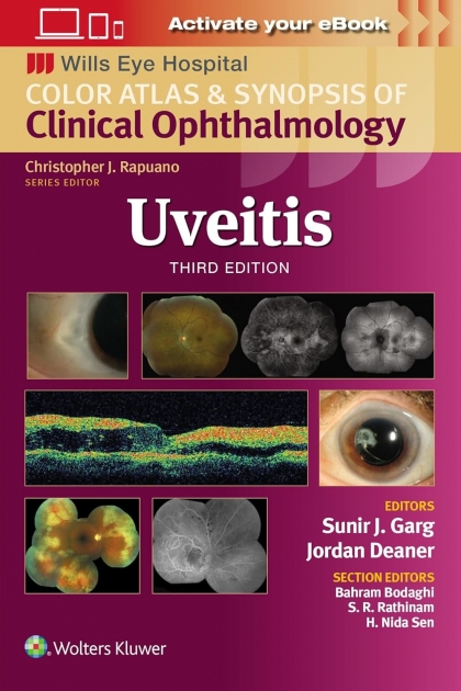 Wills Eye Institute Atlas Series: Uveitis, 3rd Edition