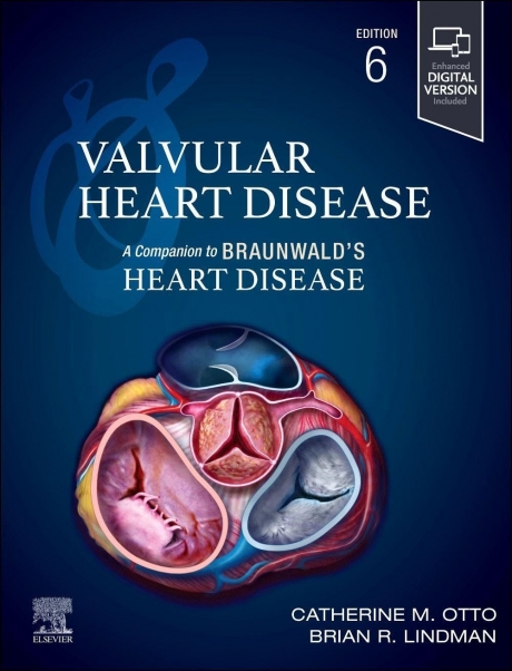 Valvular Heart Disease: A Companion to Braunwald`s Heart Disease, 6th Edition