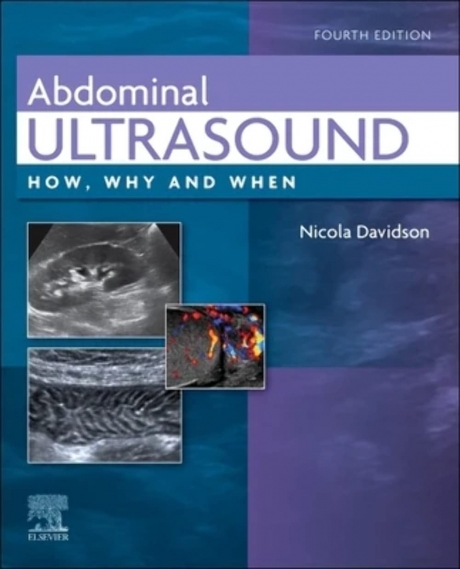 Abdominal Ultrasound: How, Why and When, 4th Edition