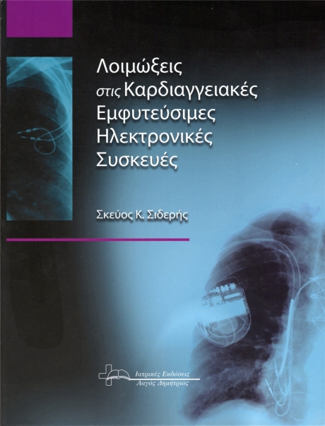 Λοιμώξεις στις Καρδιαγγειακές Εμφυτεύσιμες Ηλεκτρονικές Συσκευές