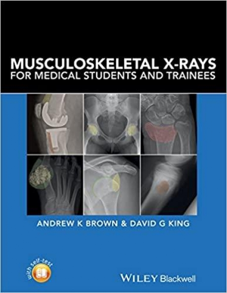 Musculoskeletal X-Rays for Medical Students and Trainees