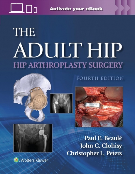 The Adult Hip: Hip Arthroplasty Surgery, 4th Edition