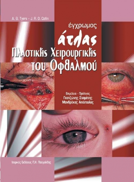 Έγχρωμος Άτλας Πλαστικής Χειρουργικής του Οφθαλμού