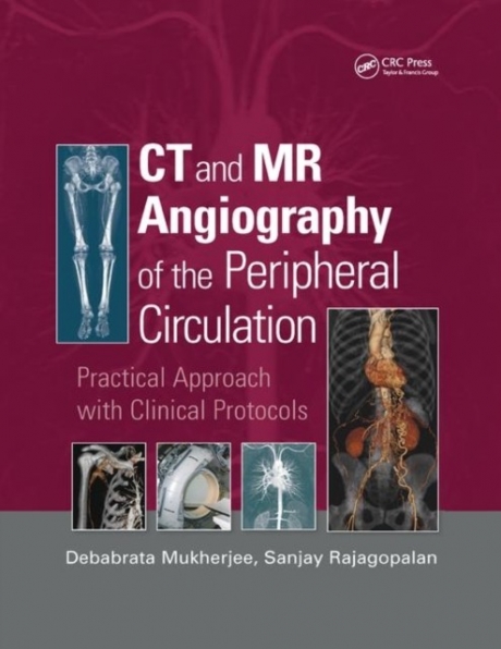 CT and MR Angiography of the Peripheral Circulation Practical Approach with Clinical Protocols