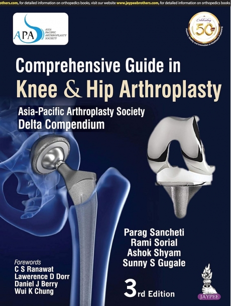 Comprehensive Guide in Knee & Hip Arthroplasty, 3rd Edition