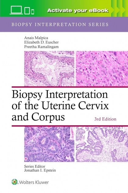 Biopsy Interpretation of the Uterine Cervix and Corpus, 3rd Edition