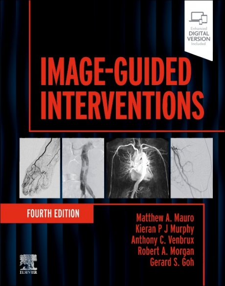 Image-Guided Interventions, 4th Edition