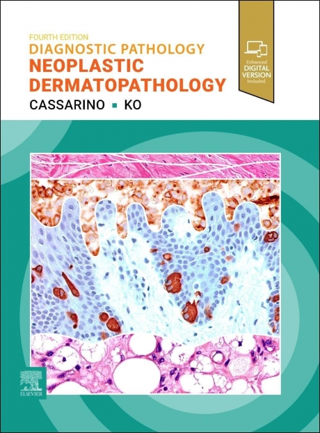 Diagnostic Pathology: Neoplastic Dermatopathology, 4th Edition